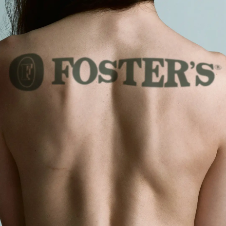 Fosters